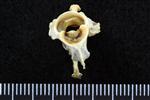 Pacific Loon (Cervical Vertebrae 2 - Axis (Axial) - Cranial)